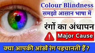 Colour Blindness आसान भाषा में, ⚠️The Shocking TRUTH About Colour Blindness,  Real Life Problems