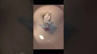 Flushing a mask down the toilet
