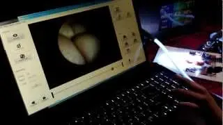 SweetVision HD, fiberscope imaging system