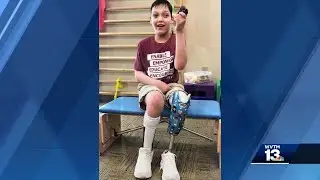 Ukrainian boy with special needs thriving in Alabama with adopted family