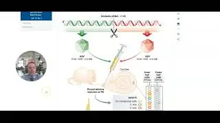 OTOF gene therapy