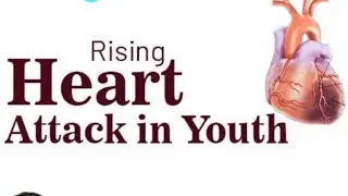 Heart Attack;Without Warning?These Signs Ignored by Millions.This Happen Minutes Before Heart Attack