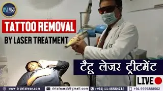 Tattoo Removal in Delhi By Laser Treatment, टैटू लेजर ट्रीटमेंट Cost, Permanent Tattoo, Dr PK Talwar