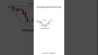 Rounding Bottom Pattern #financialtrading #trading #sharemarket #stock #tradingtips #trend #youtuber