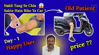 Below Knee Prosthetic in India | Artificial Leg by Ossur India | Nakli Tang Cost Explained