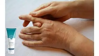 Artrivit Asli Dan Palsu