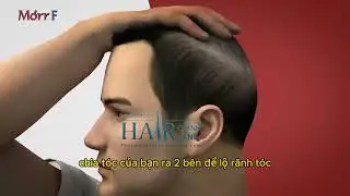 c&aacute;ch sử dụng Morr F5 - ThuocMocTocChinhHang.Com