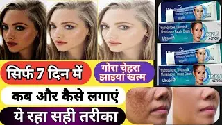 Ultrabrite skin cream, gora karne wali cream, #beauty