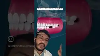 kya hota h agar samay se daant na lagwaye to #dentalbridge #dentalimplantsdelhi #agranews