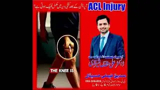 How Long Does It Take to Recover After ACL Arthroscopy? || Dr Ali Muqaddas Sherazi