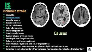 Medical Imaging Basics of Brain and Spine Emergency Full of lecture 3