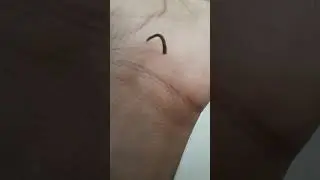 leeches