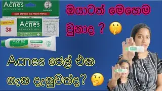Best products for pimple treatment / acnes product review in Sinhala/  කුරුලෑ වලට විසඳුම