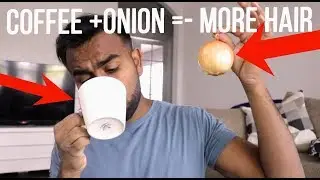 5 EASY HOME REMEDIES FOR NATURAL HAIR GROWTH | Stop Balding Naturally!
