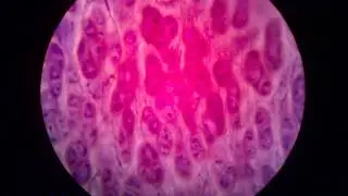 Elastic cartilage (Auricle). Эластический хрящ (ушная раковина).