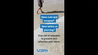 Vibrio Safety