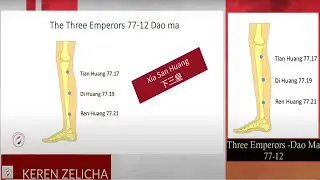 Tung's Acupuncture points- 77.17+ 77.19+ 77.21 (Lower Three Emperors) 【下三皇】