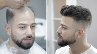 PROTEZ SAÇ - Hair Replacement