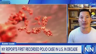 First Polio case in over a decade reported in U.S. | NewsNation Prime