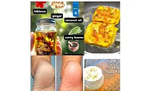 Anjana's Homemade With love is live pulda sandwich/ crack heel repairing cream/ herbal hair oil