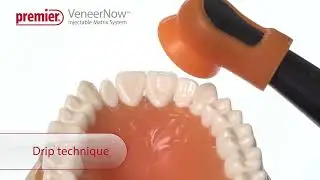 VeneerNow&trade; Injectable Matrix System - Optimize the VeneerNow&trade; Workflow
