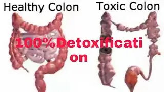 Toxiflush|Sami Direct|Detoxification