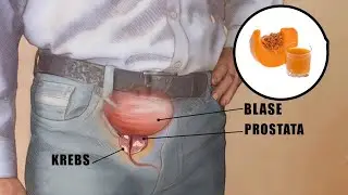 How to solve prostate problems