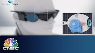 Bionic Eye Helps the Blind | Innovation Cities | CNBC International