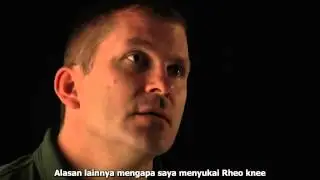 &Ouml;ssur Rheo Knee