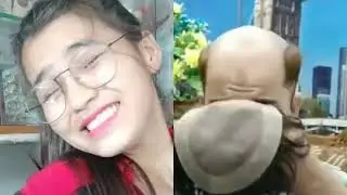 Amazing technology of hair transplantation