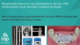 Reconstru&ccedil;&atilde;o &oacute;ssea com o uso de biomaterias: Bio-Oss, RPM reinforced ptfe mesch, Bio-Gide e Parafuso