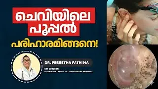 ചെവിയിലെ പൂപ്പൽ. ശാശ്വത പരിഹാരം! Itchy Ear? Know about Otomycosis.