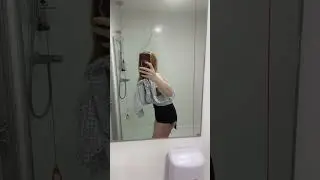 Emma&rdquo;s journey of her tummy tuck with muscle repair and liposuction