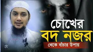 চোখের বদ নজর # chokar bod nojor #shorts