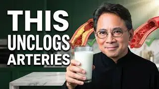 Drink This Milk Daily to UNCLOG Arteries and PREVENT Heart Attack | Dr. William Li