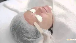 Pigmentvlekken veilig behandelen - De Huidkliniek