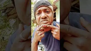 😳💦🥰Как я вылечила укус насекомого йогуртом в дикой природе | Лайфхаки для выживания #шорты #юбкас...