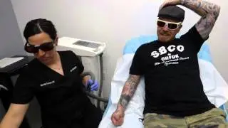 Tattoo Artist Gets Tattoo Removal & Shows Off Black Leg