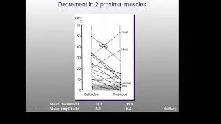 Repetetive nerve stimulation (RNS) lecture