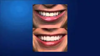 Long Beach on Choose a Dentist