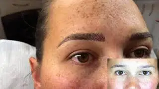 Feather Stroke Brows Straight After Tattooing - Melissa Carr
