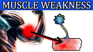 Muscle Weakness and Fatigue: Top 7 Causes