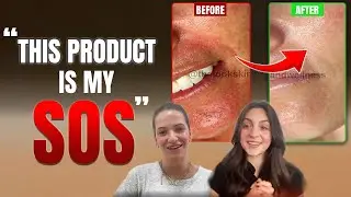 8-Week Real Results: Esthetician Tells All About Healing Inflamed Skin