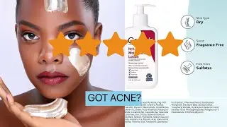 CeraVe Moisturizing Lotion for Itch Relief | Anti Itch Lotion with Pramoxine Hydrochloride |