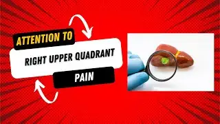 Understanding Gallbladder Stones: Symptoms and Warning Signs #health #gallstones