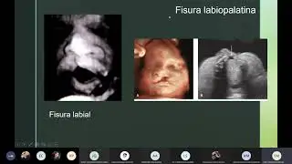 Clase 15 - Imagenología fetal (pt. III)