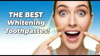 5 Best Whitening Toothpastess for 2025- (My Doctors Recommend These)