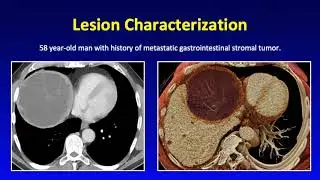 Cinematic Rendering &ndash; Liver and Pancreatic Applications