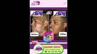 Diva Stem Cells Testimony