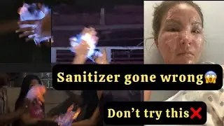 SANITIZER TREND GONE WRONG. DON&rsquo;T TRY THIS. BE RESPONSIBLE . What Happens When Trends Turn Toxic